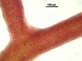 5 - Cellule corticali in visione superficiale